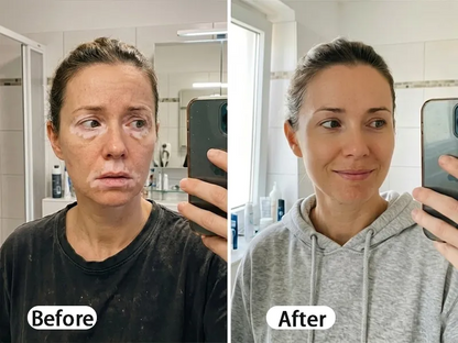 BalanceVie Vitiligo | Botanical Vitiligo Repigmentation Spray Canada
