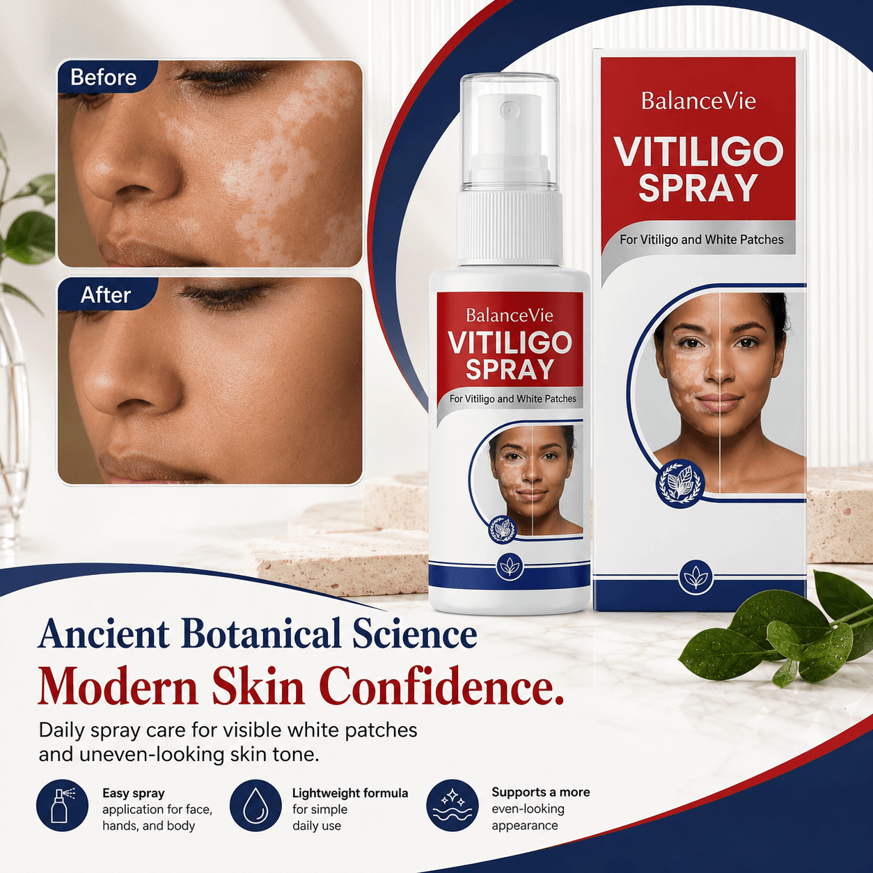 BalanceVie Vitiligo | Botanical Vitiligo Repigmentation Spray USA
