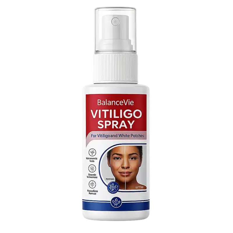 BalanceVie Vitiligo | Botanical Vitiligo Repigmentation Spray USA