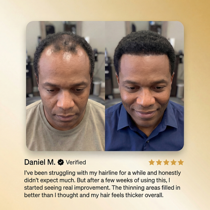 NATRAVOR® Advanced Batana Hair Regrowth Therapy
